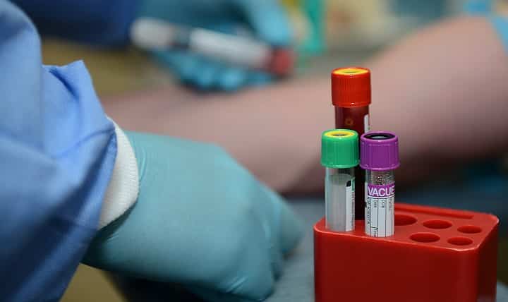 Blood Samples.